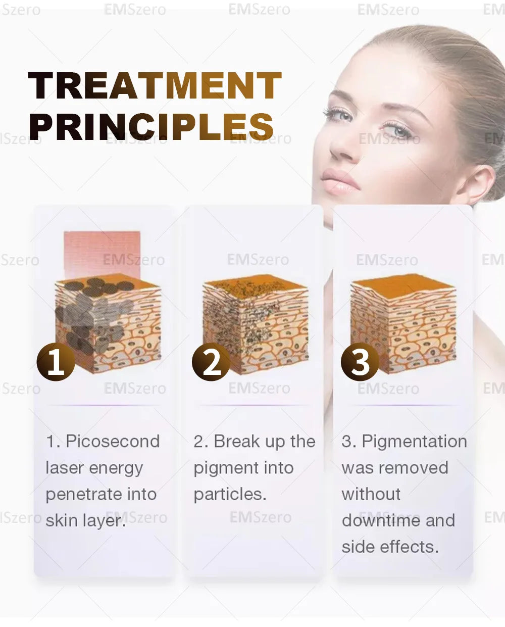 2in1 Soprano Titanium Ice Platinum Diode 755 808 1064nm 3 Wavelength Laser ND:YAG Machine Painless Hair Removal Machine