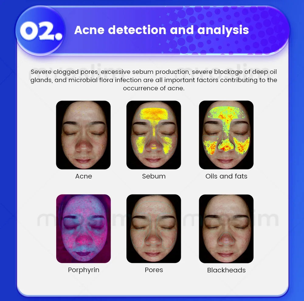 X5/X5 Pro AI Skin Image Analya Intelligence Deep Facial Skin Analysis Detector Follicle Testing Skin Analysis Magnifier