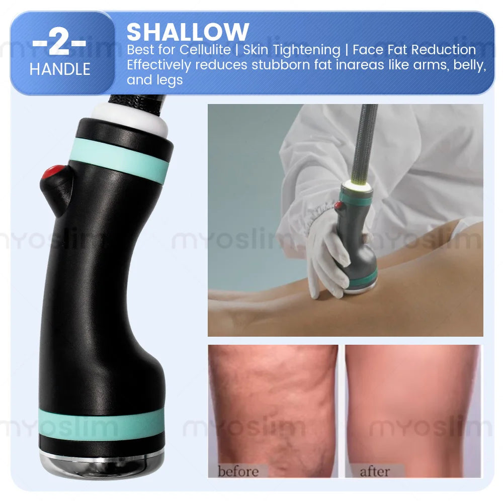 3-in-1 Non-invasive Ice Microwave Body Shaping Machine Precise Fat Dissolving Reshape Firm Skin Machine