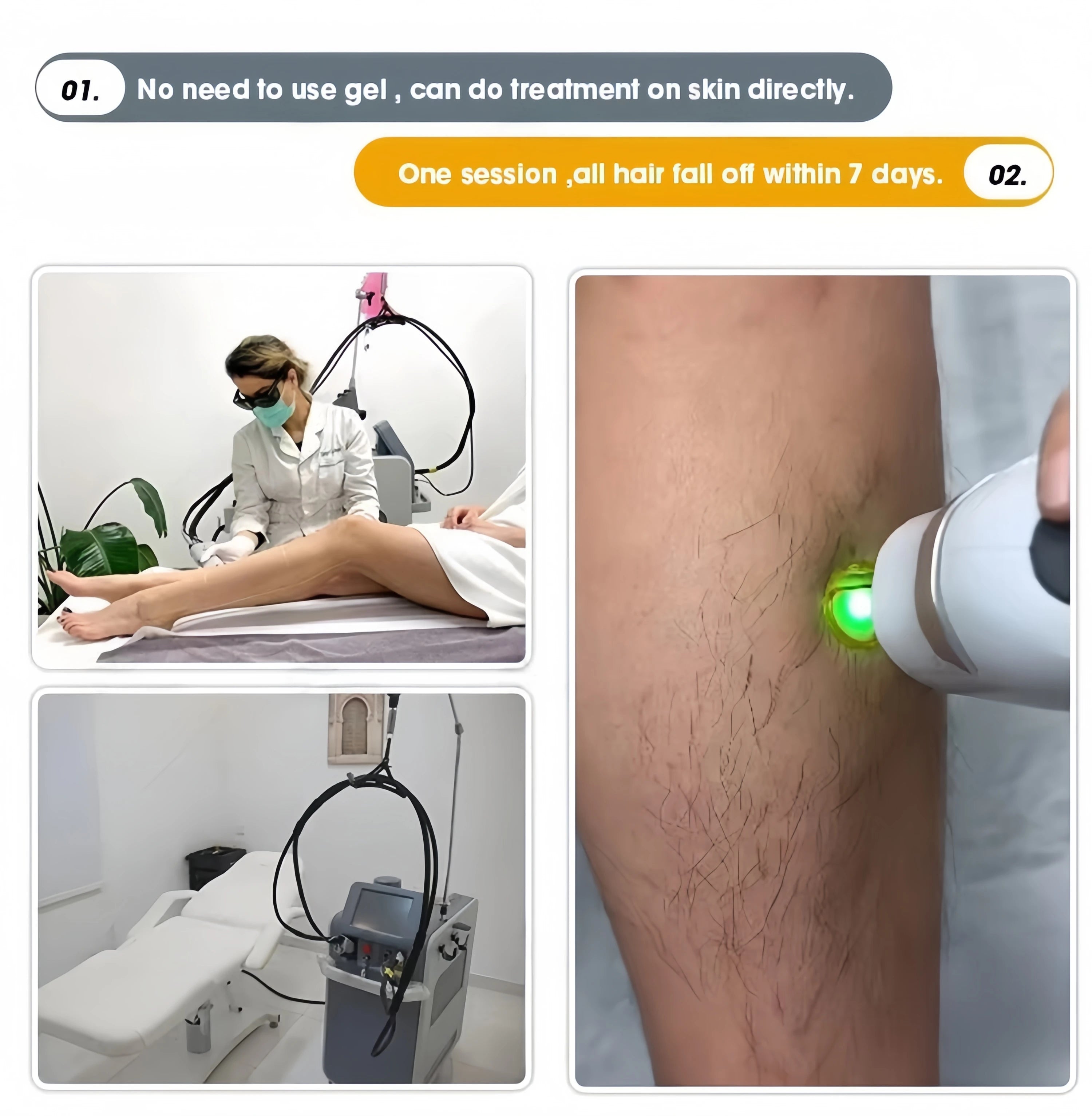 2026 SLyriclaser 1064/532nm long pulse width High quality 1064nm painless hair removal Clinic 755NM alexandrite machine