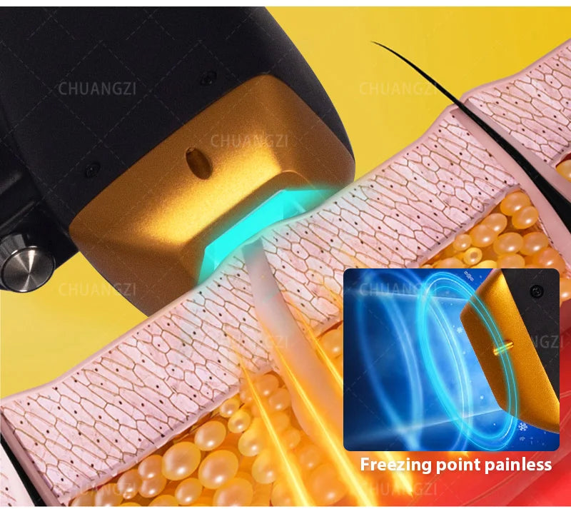 Portable Diode Ice Titanium Laser Hair Removal Machine Professional Permanent Alexandrite Device 808nm 5 Waves