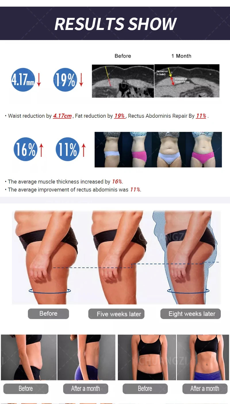 Professional EMSzero Machine 2024 RF EMS Body Sculpting Muscle Stimulator Fat Burning EMS body Slimming Device