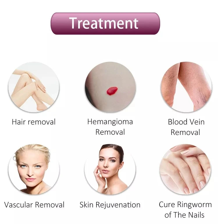 2026 SLyriclaser 1064/532nm long pulse width High quality 1064nm painless hair removal Clinic 755NM alexandrite machine