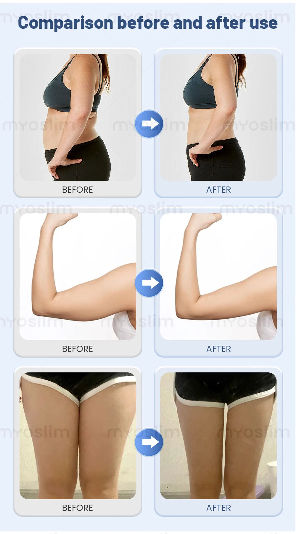 3-in-1 Non-invasive Ice Microwave Body Shaping Machine Precise Fat Dissolving Reshape Firm Skin Machine